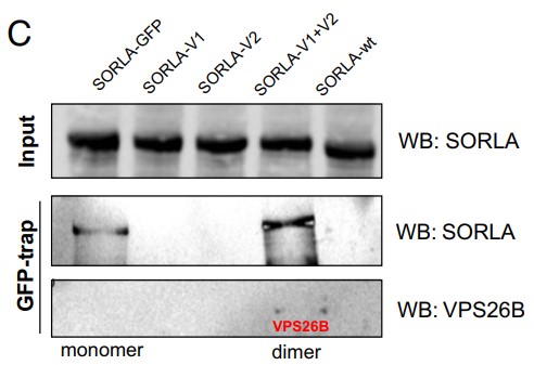 GFP-trap immunoprecipitation analysis of lysates from HEK293 cells.jpg